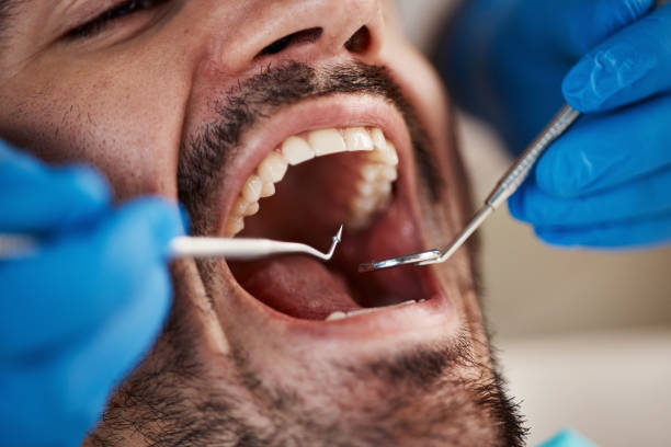 Why Choose Us for Your Dental Needs in Watsessing, NJ